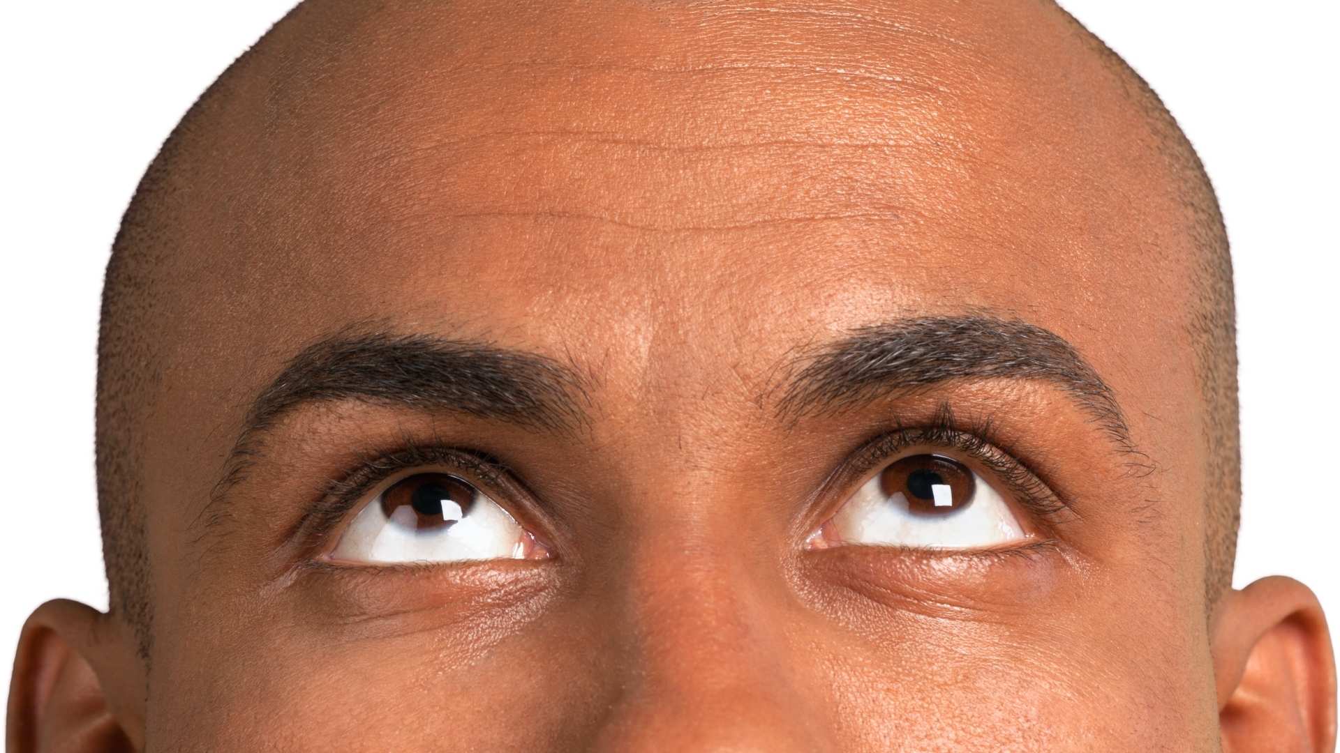 what are the first signs of a wet brain Things like confusion and abnormal eye movements