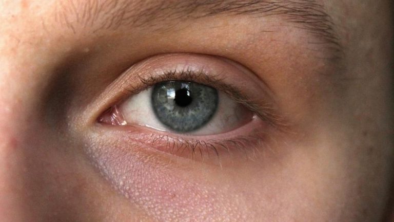 is ketamine addictive hero image of a man's eyes.
